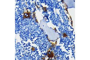 Immunohistochemistry of paraffin-embedded mouse bone marrow using Integrin beta 3 (ITGB3/CD61) (ITGB3/CD61) Rabbit mAb (ABIN7267928) at dilution of 1:100 (40x lens). (Integrin beta 3 anticorps)
