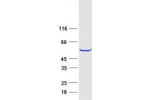 Validation with Western Blot