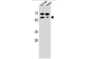 TBX6 Antibody (Center W158) western blot analysis in mouse liver tissue and Hela cell line lysates (35µg/lane). (T-Box 6 anticorps  (Middle Region))
