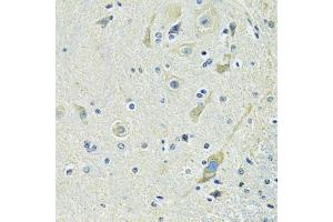 Immunohistochemistry of paraffin-embedded mouse spinal cord using SLC1A4 antibody (ABIN6292419) at dilution of 1:100 (40x lens). (SLC1A4 anticorps)