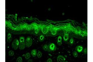 Rab5, mouse backskin.