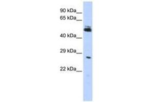 Image no. 1 for anti-Ring Finger Protein 212 (RNF212) (AA 72-121) antibody (ABIN6740828) (RNF212 anticorps  (AA 72-121))