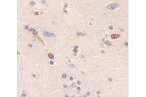 IHC-P analysis of Human Tissue, with DAB staining. (BIM anticorps  (AA 2-120))