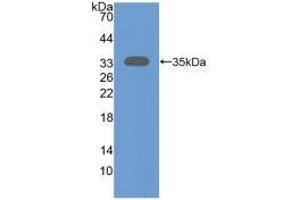 Western blot analysis of recombinant Human SIRT2. (SIRT2 anticorps  (AA 65-340))