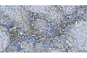 IHC analysis of GABARAP using anti-GABARAP antibody (ABIN7603159). (GABARAP anticorps  (N-Term))
