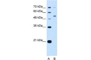 WB Suggested Anti-CDR2 Antibody Titration:  5. (CDR2 anticorps  (N-Term))