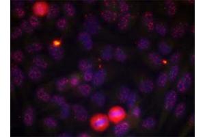 Immunofluorescence staining of methanol-fixed HeLa cells using ELK1 (phospho T417) polyclonal antibody . (ELK1 anticorps  (pThr417))