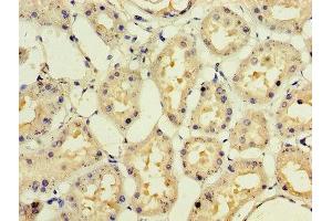Immunohistochemistry of paraffin-embedded human kidney tissue using ABIN7141980 at dilution of 1:100 (IFNA1 anticorps  (AA 24-189))