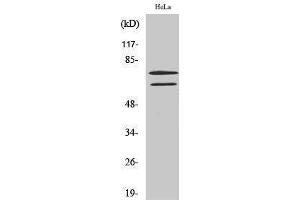 Western Blotting (WB) image for anti-Lamin A/C (LMNA) (Ser78) antibody (ABIN6280093)