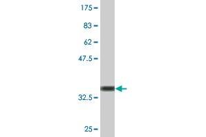Western Blot detection against Immunogen (38. (JNK anticorps  (AA 318-427))