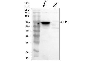 Western blot analysis of CD5 using anti-CD5 antibody (ABIN5693203). (CD5 anticorps  (AA 25-495))