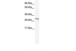 Image no. 1 for anti-Short Stature Homeobox 2 (SHOX2) (AA 180-229) antibody (ABIN6735956)
