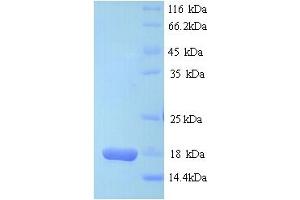SDS-PAGE (SDS) image for D-Dopachrome Tautomerase (DDT) (AA 2-118) protein (His tag) (ABIN5713400) (DDT Protein (AA 2-118) (His tag))