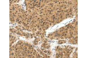 Immunohistochemistry (IHC) image for anti-Telomeric Repeat Binding Factor 2 (TERF2) antibody (ABIN2426457)