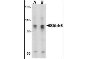 Western blot analysis of Slitrk6 in SK-N-SH cell lysate with this product at (A) 0. (SLITRK6 anticorps  (C-Term))