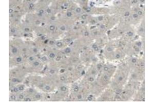 Detection of MTUS1 in Human Liver Tissue using Polyclonal Antibody to Mitochondrial Tumor Suppressor 1 (MTUS1)