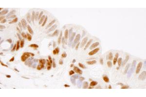 Immunohistochemistry (IHC) image for anti-General Transcription Factor III (GTF2I) (AA 985-998) antibody (ABIN7448971)