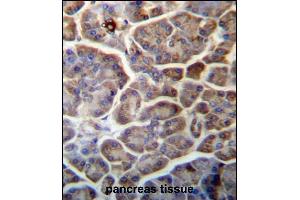 SNX29 Antibody (C-term) (ABIN657262 and ABIN2846357) immunohistochemistry analysis in formalin fixed and paraffin embedded human pancreas tissue followed by peroxidase conjugation of the secondary antibody and DAB staining. (SNX29 anticorps  (C-Term))