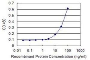 Detection limit for recombinant GST tagged TIMM8B is 3 ng/ml as a capture antibody.