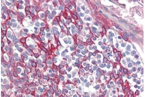 Human Tonsil (formalin-fixed, paraffin-embedded) stained with TRIM8 antibody ABIN462222 followed by biotinylated goat anti-rabbit IgG secondary antibody ABIN481713, alkaline phosphatase-streptavidin and chromogen.