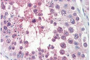 Human Testis (formalin-fixed, paraffin-embedded) stained with TRIM8 antibody ABIN462222 followed by biotinylated goat anti-rabbit IgG secondary antibody ABIN481713, alkaline phosphatase-streptavidin and chromogen.