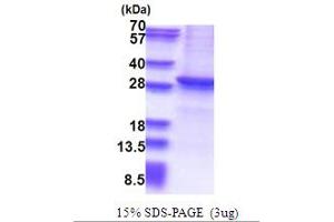 SDS-PAGE (SDS) image for Sirtuin 1 (SIRT1) (AA 254-495) protein (His tag) (ABIN5853631)