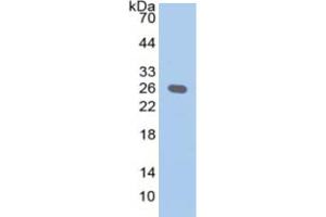 WB of Protein Standard: different control antibodies against Highly purified E. (EBI3 Kit CLIA)