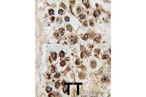 Formalin-fixed and paraffin-embedded human testis tissue reacted with MLLT10 polyclonal antibody  , which was peroxidase-conjugated to the secondary antibody, followed by DAB staining. (MLLT10 anticorps  (C-Term))
