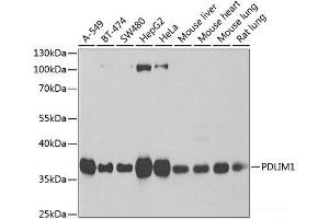 Western blot analysis of extracts of various cell lines using PDLIM1 Polyclonal Antibody at dilution of 1:1000. (PDLIM1 anticorps)