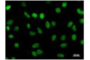 Immunostaining analysis in HeLa cells.