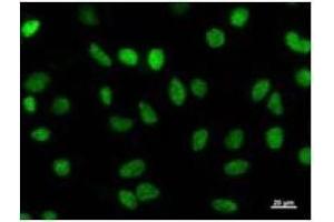 Immunostaining analysis in HeLa cells. (HEXIM1 anticorps)