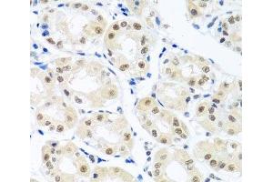 Immunohistochemistry of paraffin-embedded Human stomach using THOC1 Polyclonal Antibody at dilution of 1:100 (40x lens). (THOC1 anticorps)