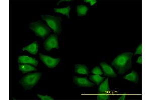 Immunofluorescence of monoclonal antibody to TXN on HeLa cell. (TXN anticorps  (AA 1-105))