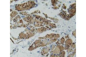IHC-P analysis of rectum tissue, with DAB staining.
