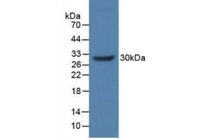 Detection of Recombinant MUC17, Human using Polyclonal Antibody to Mucin 17 (MUC17) (MUC17 anticorps  (AA 3773-3998))