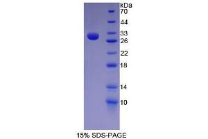 SDS-PAGE analysis of Human Nestin Protein.