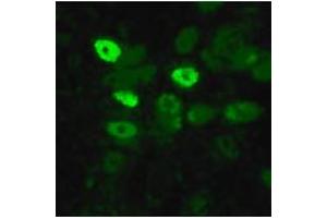 Image no. 1 for anti-Influenza Nucleoprotein antibody (Influenza A Virus) (AA 428-441) (ABIN200003)