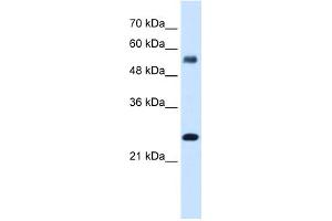 SMAD1 antibody - N-terminal region  validated by WB using Transfected 293T cell lysate at 2. (SMAD1 anticorps  (N-Term))