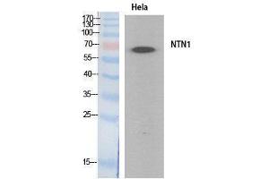 Western Blotting (WB) image for anti-Netrin 1 (NTN1) (Internal Region) antibody (ABIN3181063) (Netrin 1 anticorps  (Internal Region))