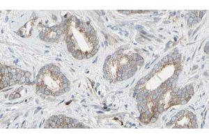 ABIN6268954 at 1/100 staining Human prostate tissue by IHC-P. (EIF4B anticorps  (Internal Region))