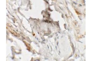 Immunohistochemistry (IHC) image for anti-Hedgehog Acyltransferase-Like (HHATL) (N-Term) antibody (ABIN1031403) (HHATL anticorps  (N-Term))