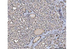 IHC analysis of hnRNP U/p120/HNRNPU using anti-hnRNP U/p120/HNRNPU antibody (ABIN7600979).