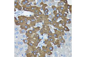 Immunohistochemistry of paraffin-embedded mouse liver using Argonaute-2 antibody (ABIN7265671) at dilution of 1:100 (40x lens). (AGO2 anticorps)
