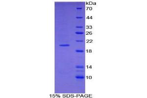 SDS-PAGE analysis of Mouse COL3A1 Protein. (COL3A1 Protéine)
