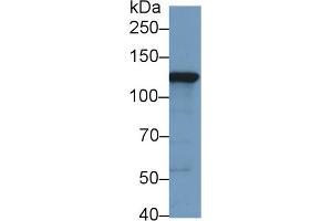 Western Blot; Sample: Human HepG2 cell lysate; Primary Ab: 1µg/ml Rabbit Anti-Human HK2 Antibody Second Ab: 0. (Hexokinase 2 anticorps  (AA 619-917))
