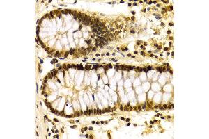 Immunohistochemistry of paraffin-embedded Human colon using KPNA4 antibody at dilution of 1:100 (x400 lens).