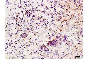Immunohistochemistry (IHC) image for anti-Colony Stimulating Factor 3 (Granulocyte) (CSF3) (AA 155-198) antibody (ABIN736521) (G-CSF anticorps  (AA 155-198))