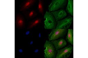 ABIN6258815 and ABIN6273506 staining  cells by IF/ICC.