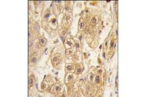 Image no. 2 for anti-Platelet Derived Growth Factor Receptor beta (PDGFRB) antibody (ABIN359922) (PDGFRB anticorps)