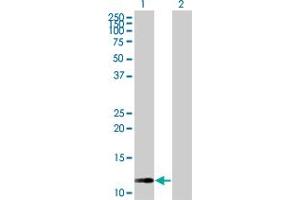 Western Blot analysis of RAB42 expression in transfected 293T cell line by RAB42 MaxPab polyclonal antibody.
